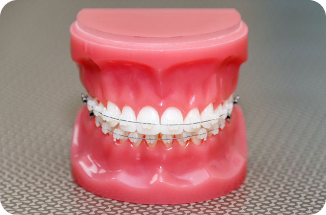 安心のトータルフィーシステムで明白な料金設定