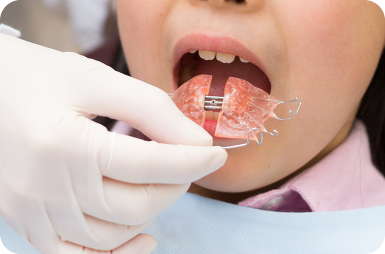 一人ひとりに適した矯正治療を提供します